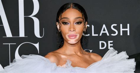 winnie harlow net worth|Winnie Harlow Net Worth – Equity Atlas